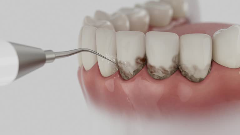 Trusted Teeth Whitening service in Pine Bluff, AR - Dentist Open Now
